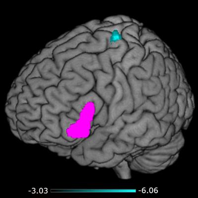 Associations Between Sign Language Skills and Resting-State Functional Connectivity in Deaf Early Signers